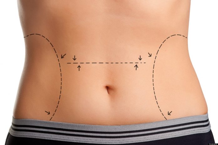 avantajele-abdominoplastiei.jpg