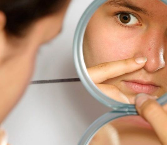 Ceaiul verde poate ajuta tratamentul acneei?