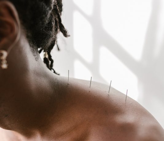 Efecte benefice ale acupuncturii